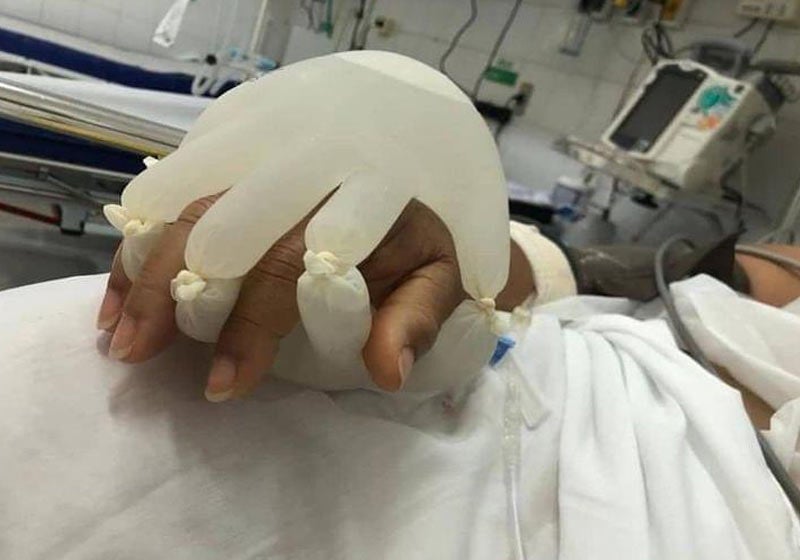 Diretor da OMS elogia técnica da mãozinha criada por enfermeira brasileira