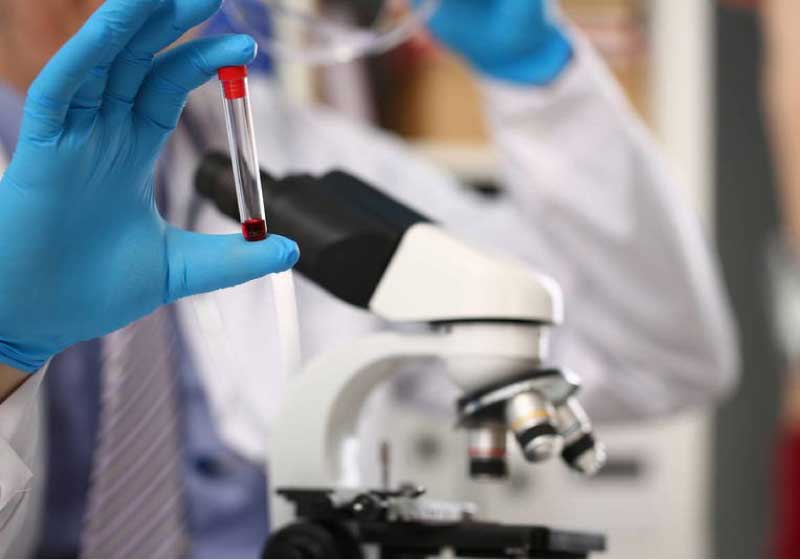 Pesquisadores da USP criam enzima menos agressiva para tratar leucemia