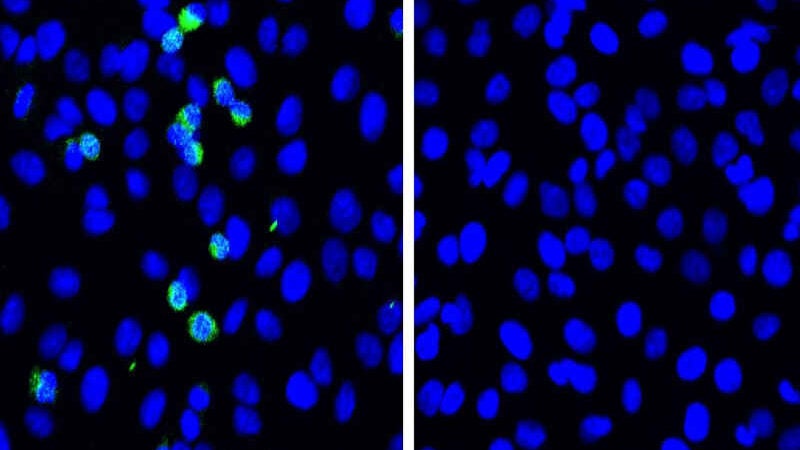 Japoneses identificam proteína que impede replicação da Covid