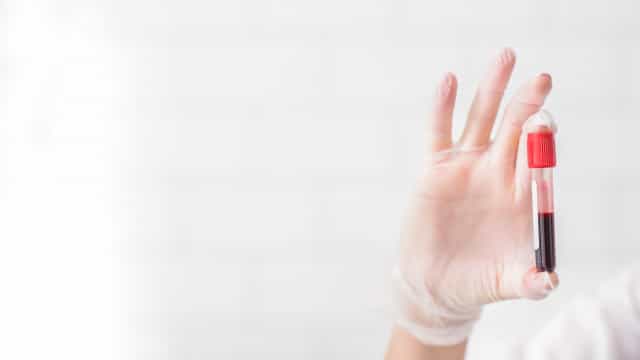 Instituto Nacional de Cardiologia no Rio pede doações de sangue