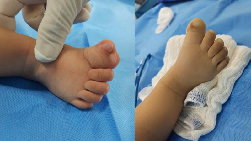 Médico abre mão de pagamento e opera bebê sem cobrar honorários