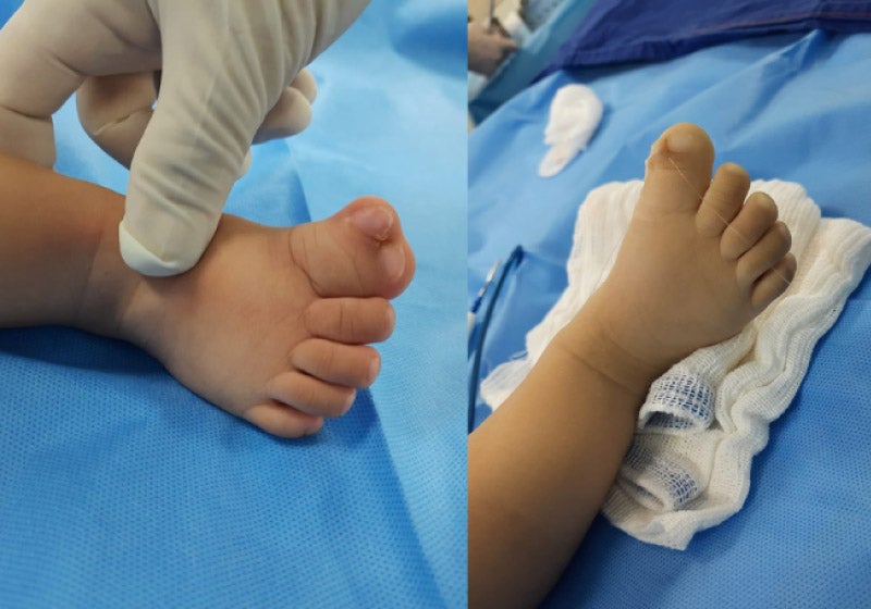 Médico abre mão de pagamento e opera bebê sem cobrar honorários