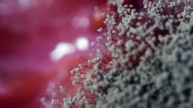 Morre paciente de covid com suspeita de infecção por ‘fungo preto’ no MS