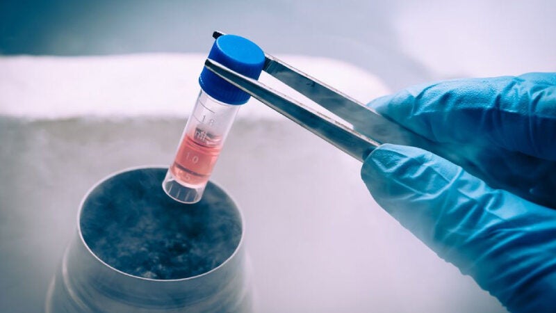 Transplante de células-tronco pode ajudar a tratar esclerose, diz estudo