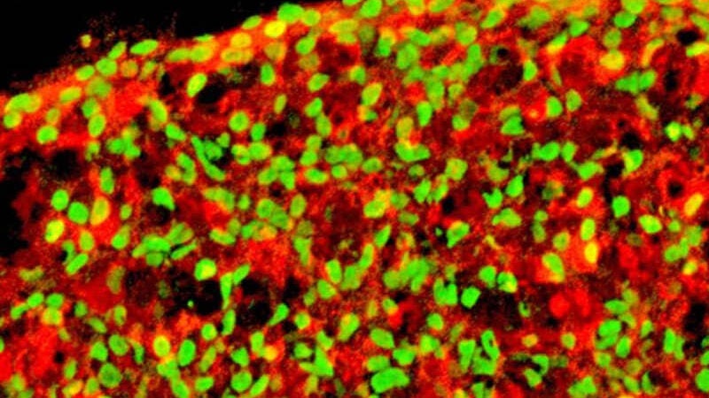 Cientistas testam células-tronco com sucesso para cura do diabetes tipo 1
