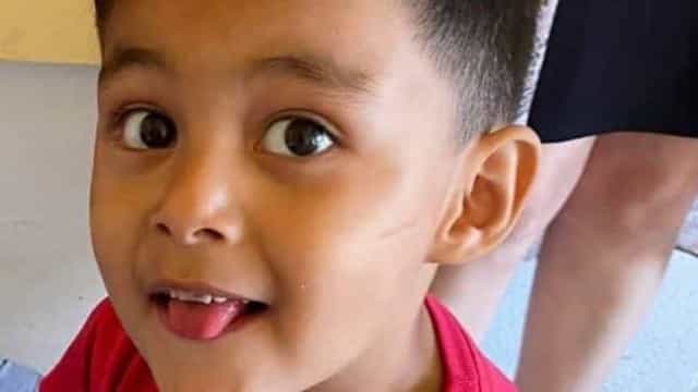 Criança de 3 anos morre após anestesia durante ida ao dentista