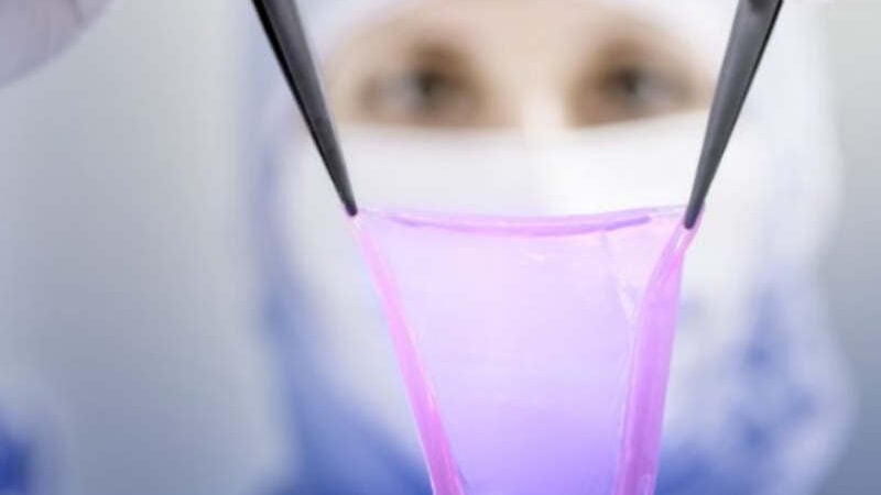 Máquina desenvolve nova pele para pacientes com queimaduras