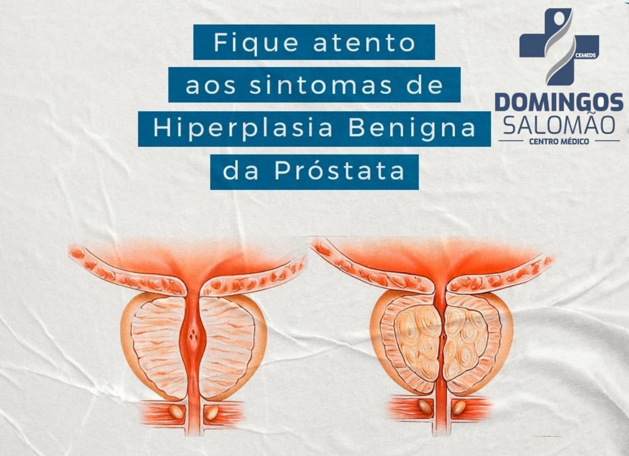 Homens acima dos 50 anos façam sua consulta com o Urologista