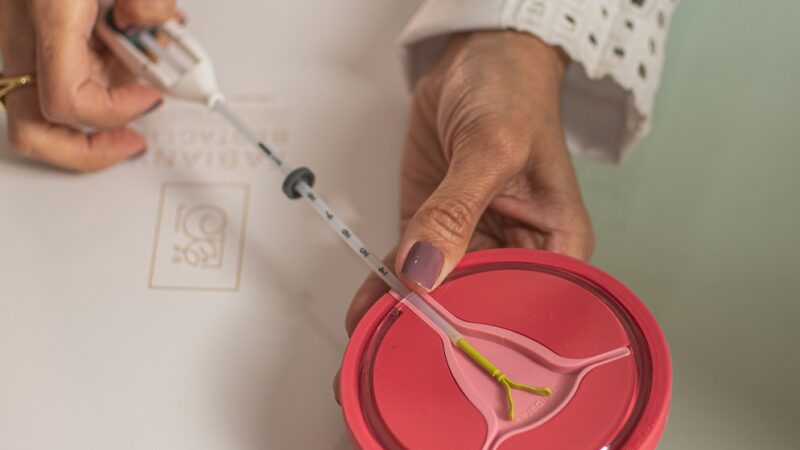 DIU e implante são métodos altamente eficazes, garante médica de Cuiabá