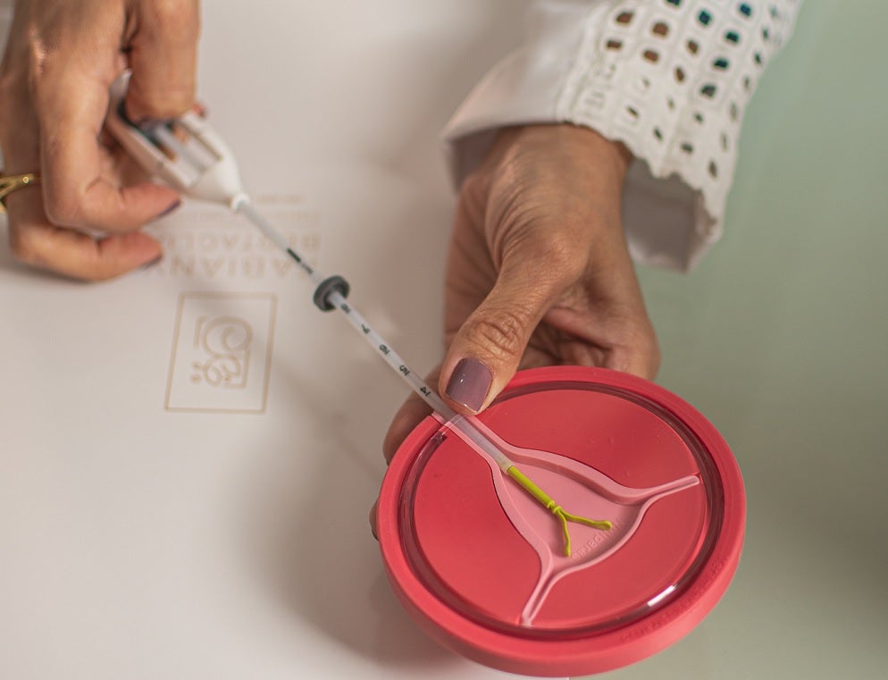 DIU e implante são métodos altamente eficazes, garante médica de Cuiabá