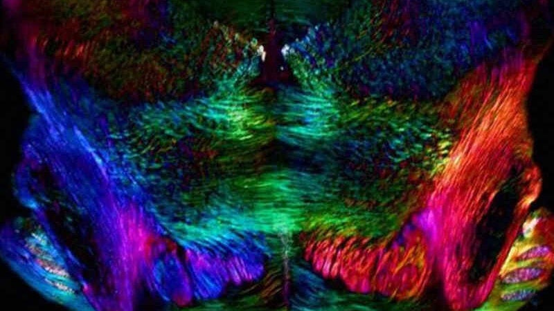 Cientistas revertem perda de memória com composto já usado em humanos