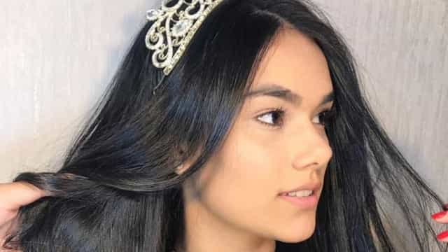 Miss Roraima Teen morre aos 21 anos durante cirurgia de emergência