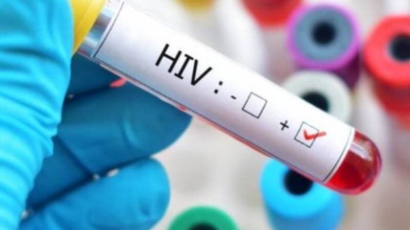 USP entra em rede global de cientistas para encontrar a cura do HIV