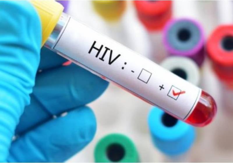 USP entra em rede global de cientistas para encontrar a cura do HIV