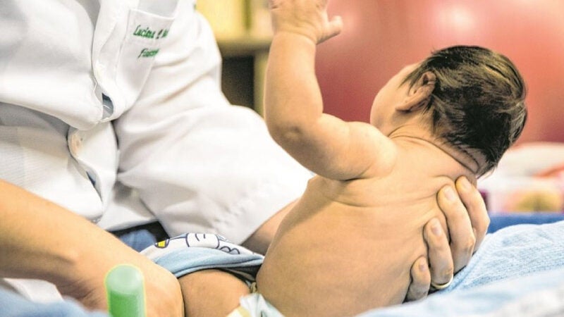 Ceará comemora 3 anos sem casos de microcefalia por Zika vírus