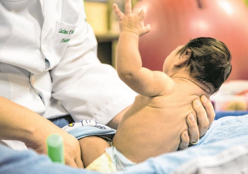 Ceará comemora 3 anos sem casos de microcefalia por Zika vírus