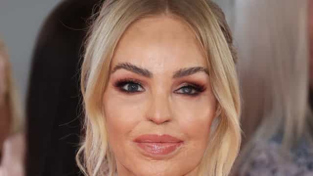 Apresentadora atacada com ácido rebate acusação de excesso de botox