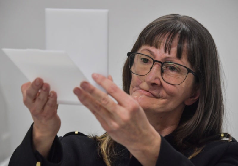 Pessoas com rosto desfigurado ganham reabilitação gratuita