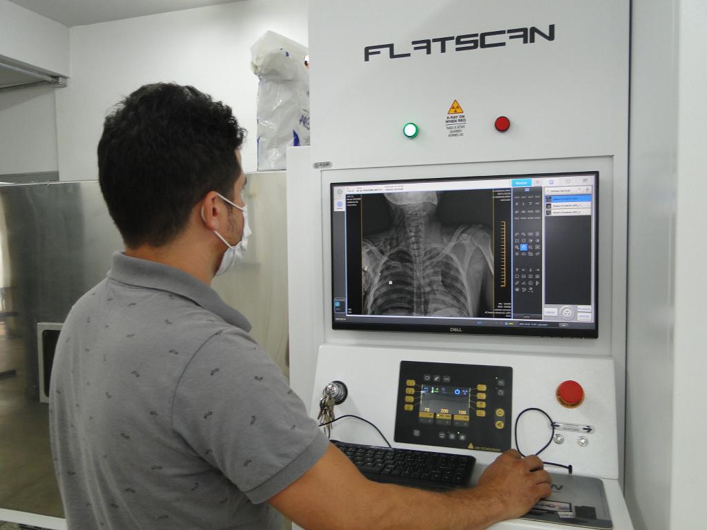 Politec adquire scanner corporal digital para localização de projéteis e outras lesões em vítimas