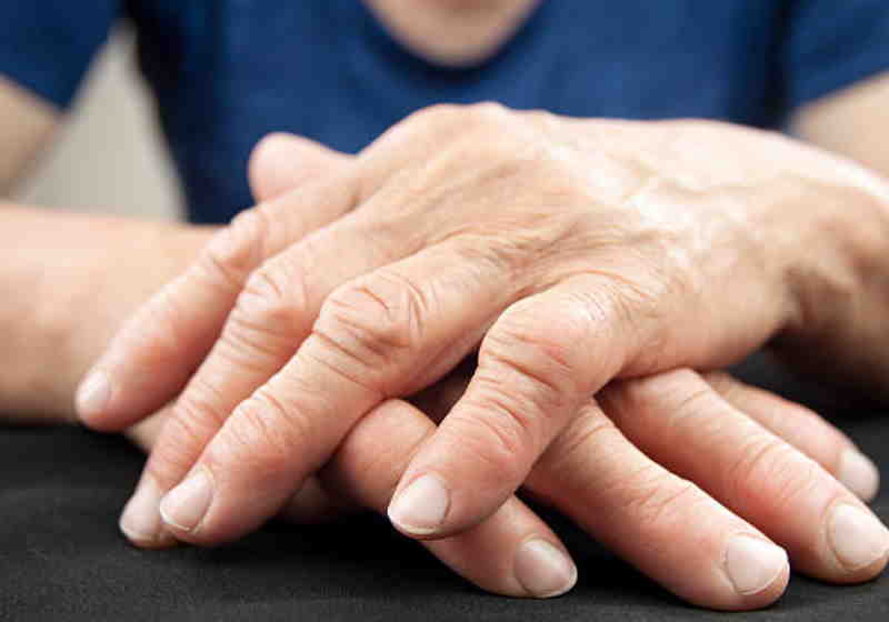 Médicos desenvolvem vacina que protege contra artrite reumatoide