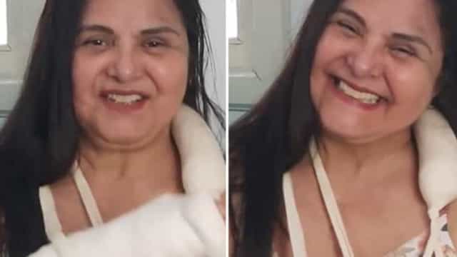 Atriz Elizangela sofre acidente em casa e fratura antebraços