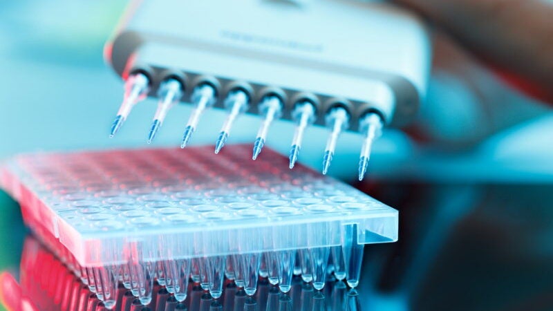 Vacina contra Alzheimer começa a ser testada em humanos