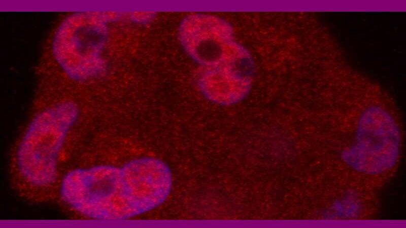Descoberta proteína que impede evolução do câncer de próstata