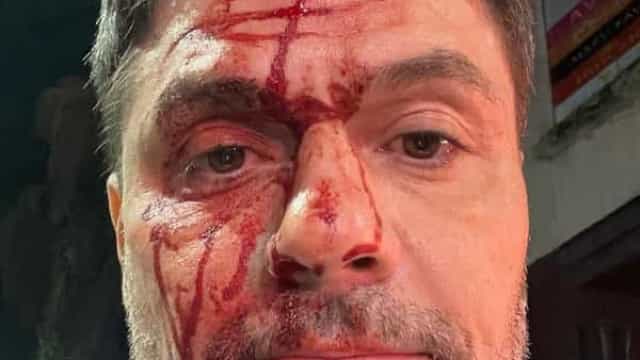 Irmão de Rodrigo Faro sofre acidente de carro e se recupera bem