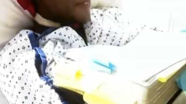 Mulher não vacinada tem os braços amputados devido à Covid-19