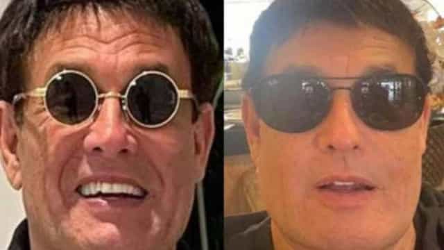 Sérgio Mallandro faz harmonização facial e compartilha resultado