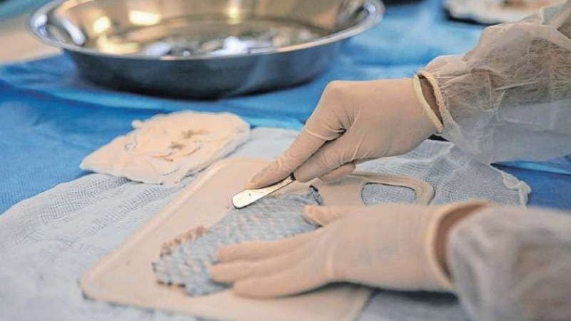 Hospital usa pele de tilápia para tratar doença rara em mulheres