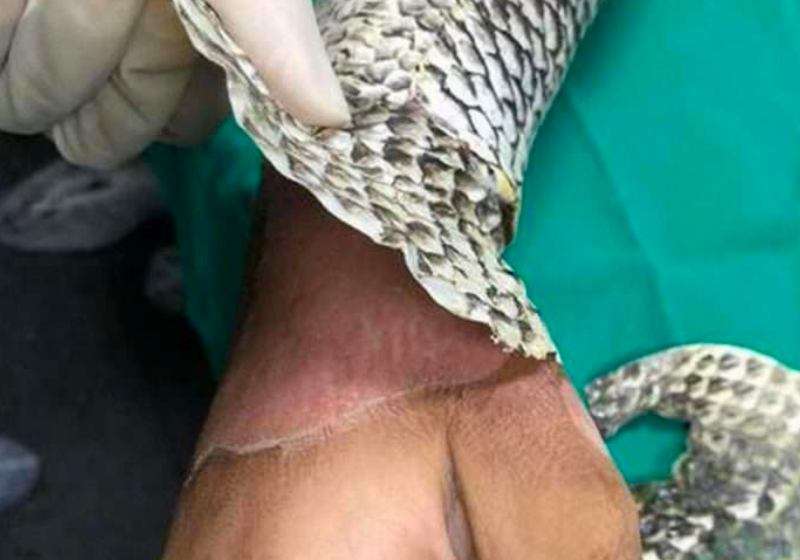 Pesquisas sobre uso medicinal da pele de tilápia ganham 3 prêmios