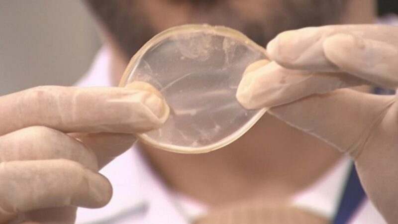 UFMT desenvolve curativo de queimadura com babosa e própolis