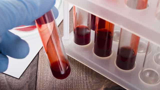 Anvisa atualiza critérios para seleção de doadores de sangue na pandemia