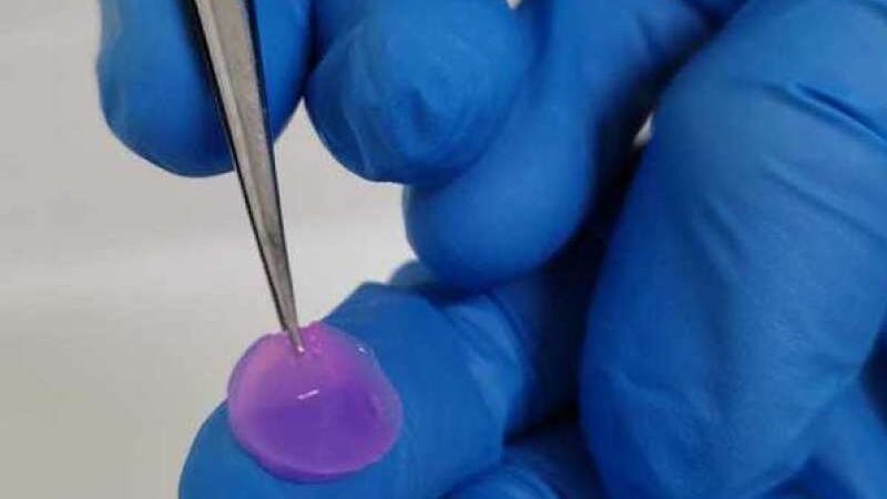 Biocurativo impresso em 3D é o futuro para tratar queimaduras
