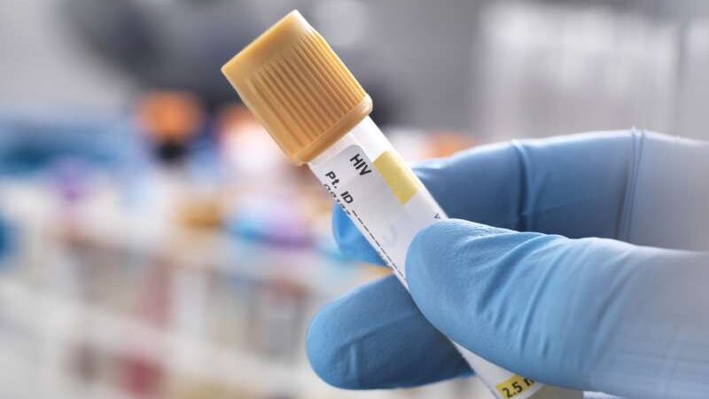 Mulher é curada do HIV após transplante de células-tronco