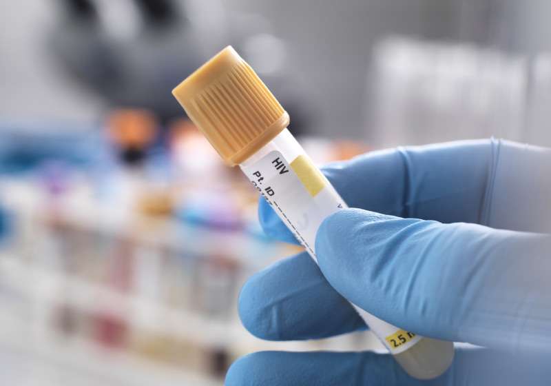 Mulher é curada do HIV após transplante de células-tronco