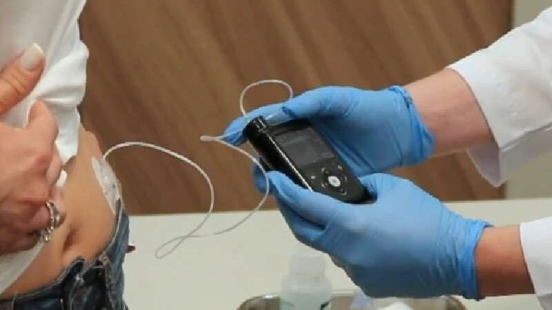 1º implante de pâncreas artificial é realizado no Brasil: diabetes