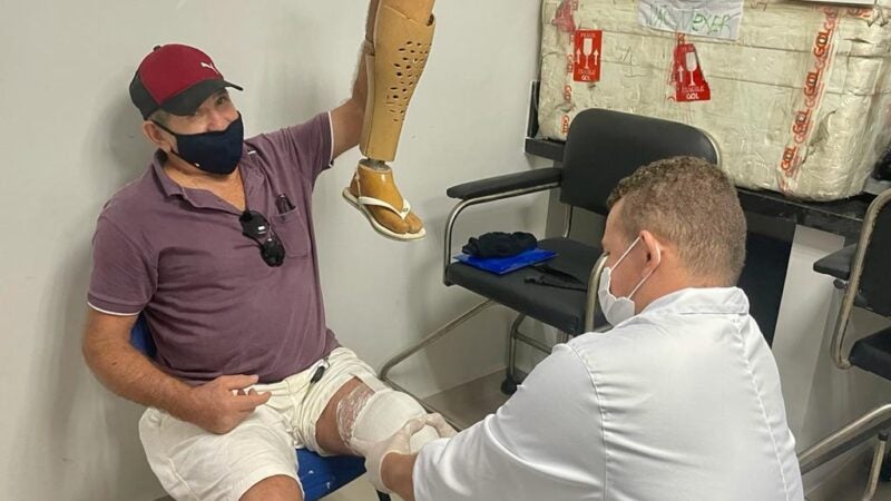 SES realiza mutirão para atender pacientes que precisam de próteses ortopédicas