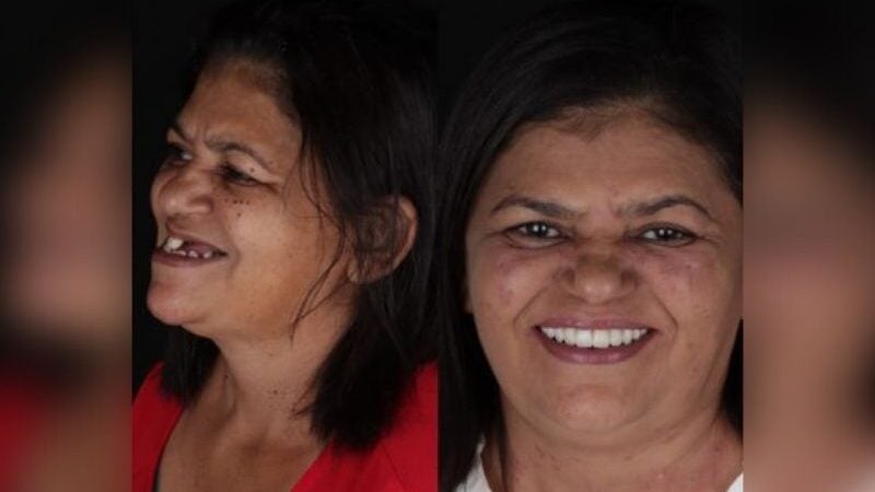 Após 26 anos, filho realiza sonho da mãe de arrumar os dentes. “Ela não sorria”