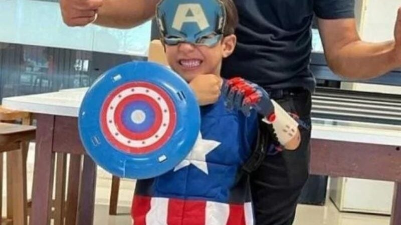 Menino de 5 anos ganha prótese de mão do Capitão América