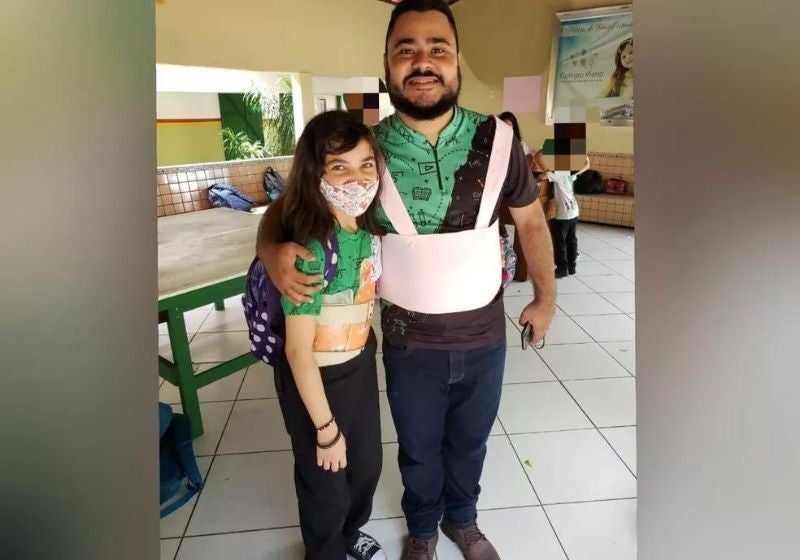 Para combater bullying, professor usa colete igual de aluna com escoliose