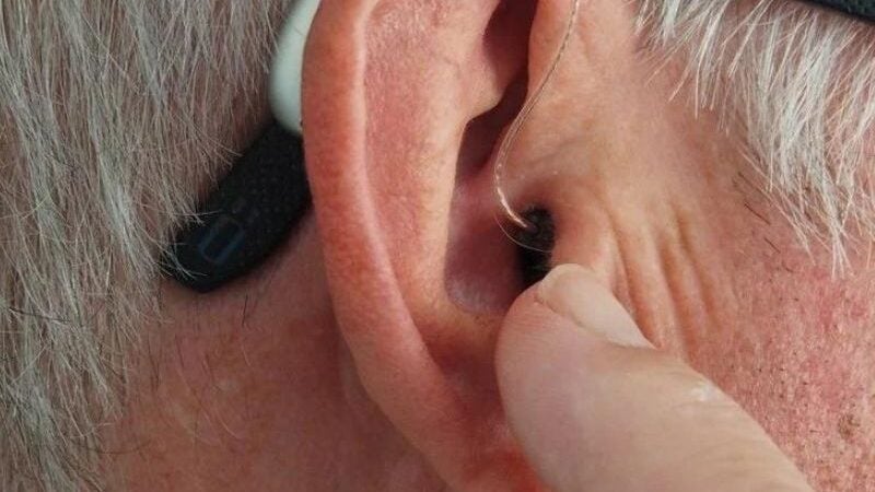 Pesquisadores do EUA desenvolvem tratamento que reverte a surdez