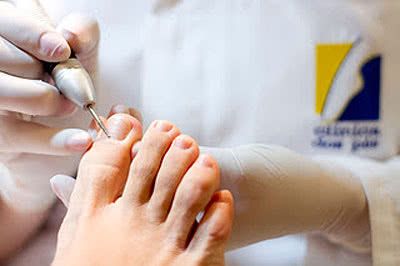 A UniFCV de Guarantã do Norte oferece o curso de Podologia