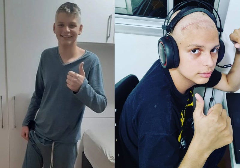 Adolescente brasileiro pede ajuda para ir Canadá tratar câncer raro