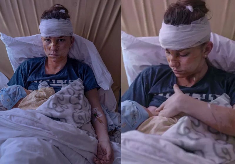 Mãe ucraniana usa o próprio corpo e salva bebê de bombardeios