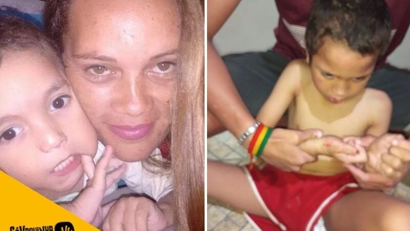 Vaquinha ajuda mãe de menino autista com crises de autoagressão