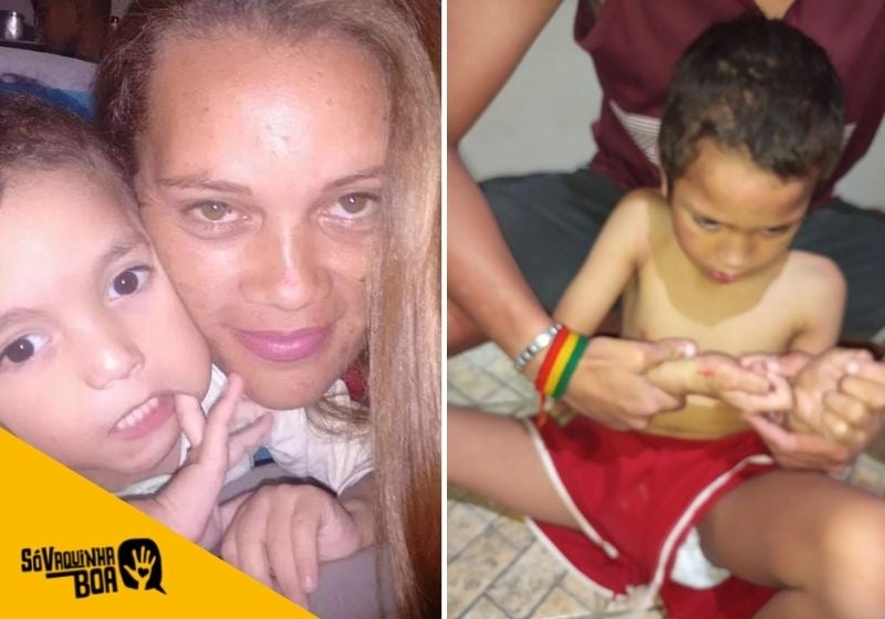 Vaquinha ajuda mãe de menino autista com crises de autoagressão