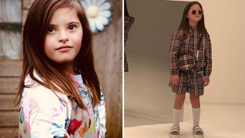 Conheça a mais nova modelo com síndrome de Down da Burberry