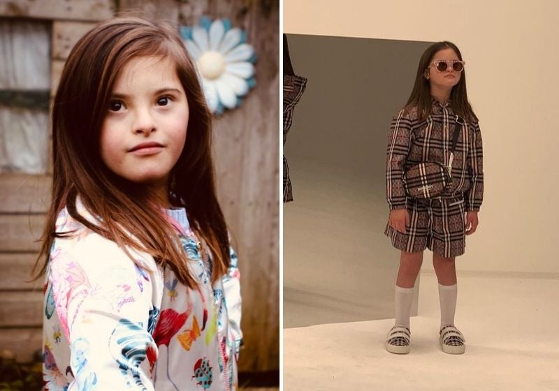 Conheça a mais nova modelo com síndrome de Down da Burberry